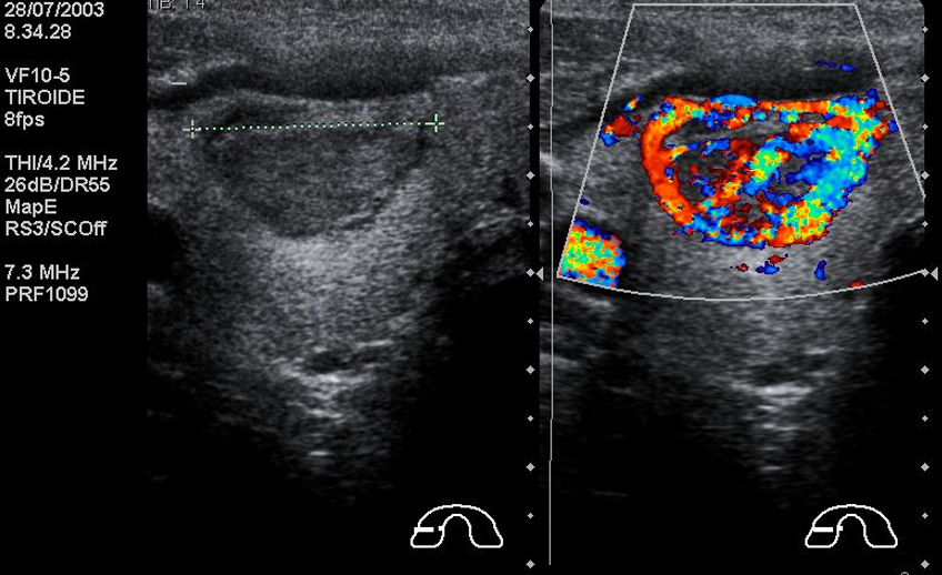 ecolordoppler_radiologia_palumbo_giugliano_napoli
